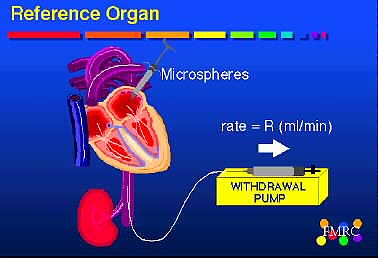 Withdrawal pump is reference organ